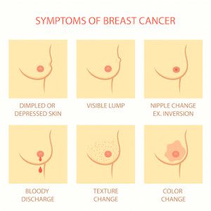 BreastCASymptoms